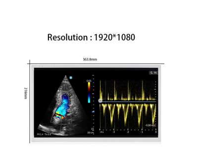 TIANMA 15.6" P1560FHF1MB00 Industrial LCD | FHD 400 Nits IPS Display